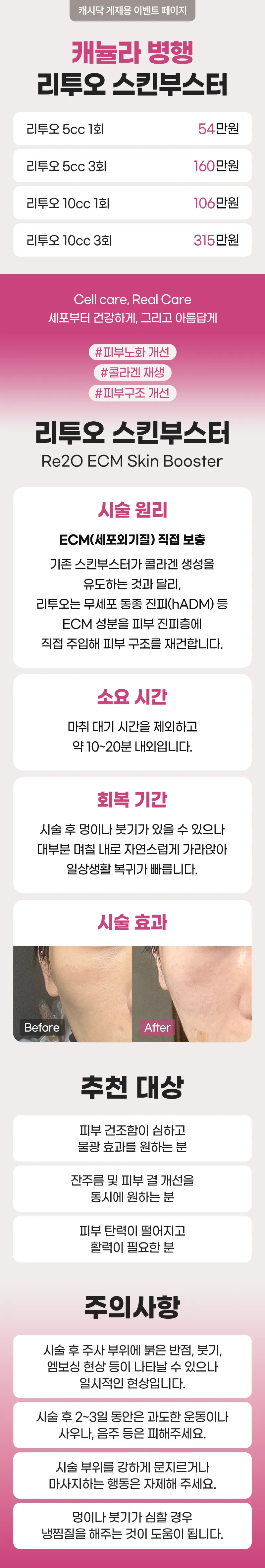 서래셀의원 [캐뉼라 병행] 리투오 스킨부스터 이벤트, 시술 상세 이미지