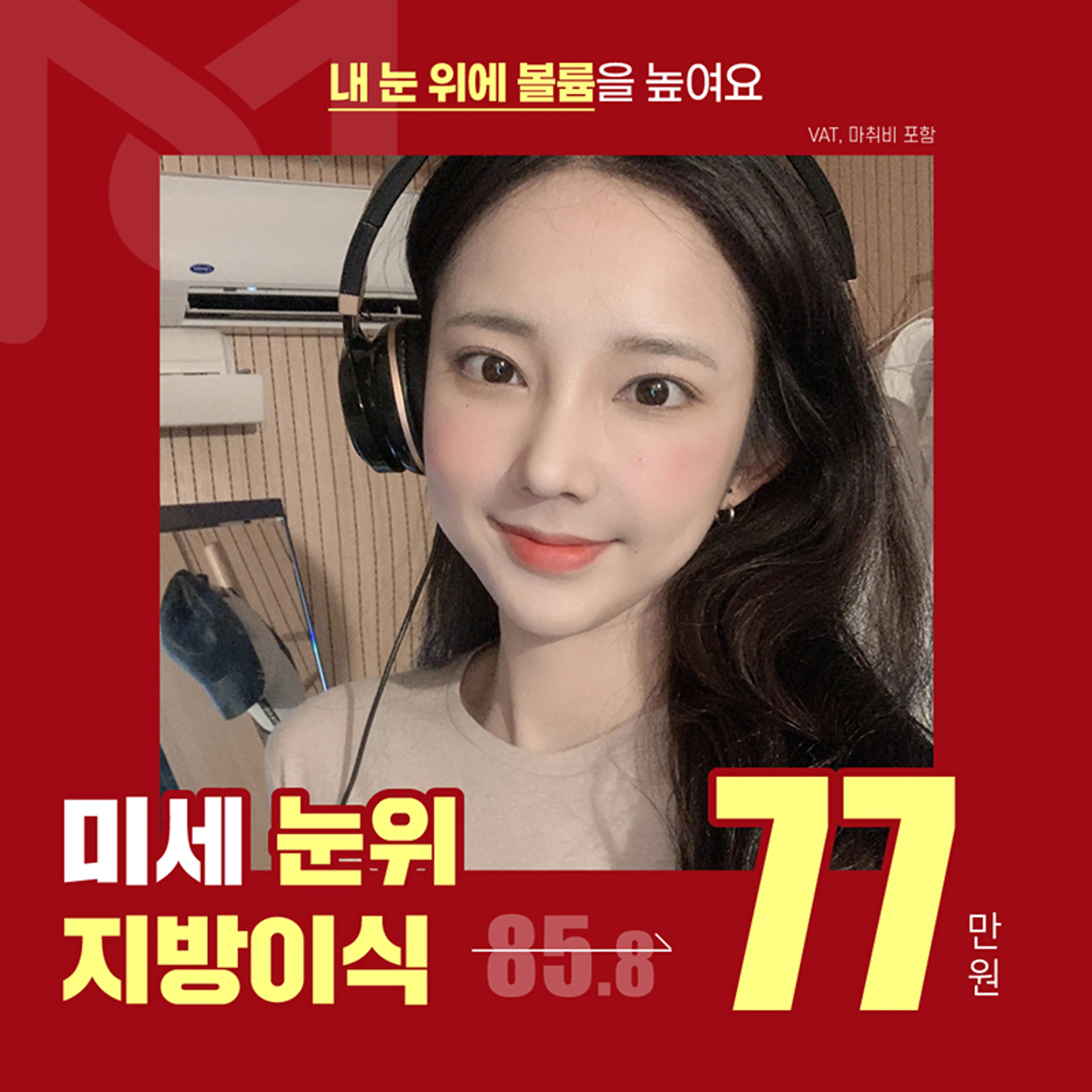 눈위눈꺼풀꺼진눈지방이식