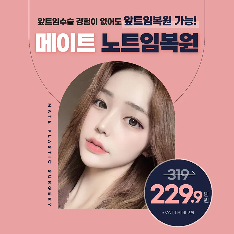 메이트 노트임복원 이벤트 썸네일 이미지