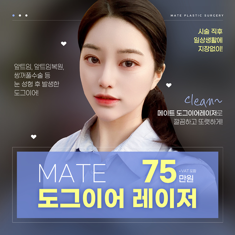 메이트 도그이어 레이저 이벤트 썸네일 이미지