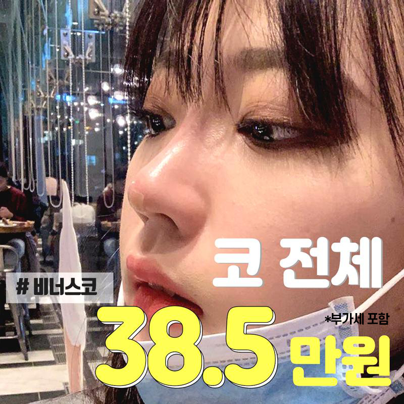 하이코 코필러, 비너스코