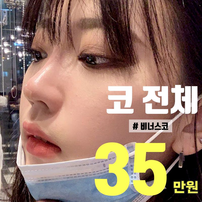 하이코 코필러, 비너스코 이벤트 썸네일 이미지