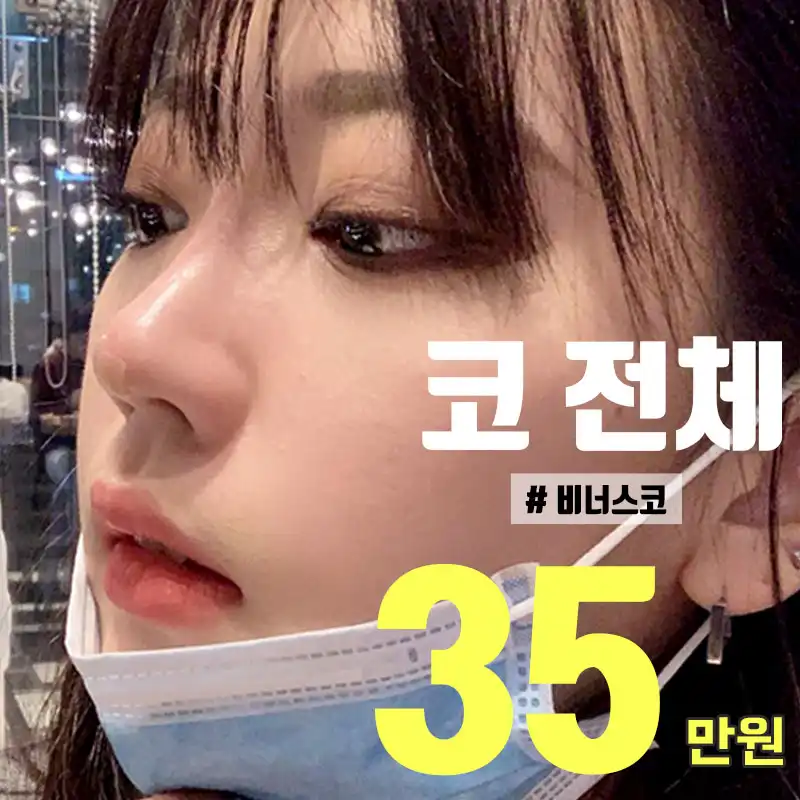 하이코 코필러, 비너스코