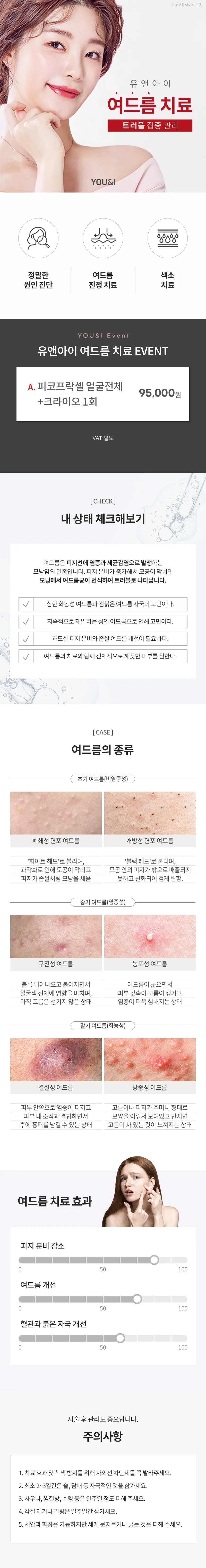 유앤아이의원 화성봉담점 봉담) 깨끗한 피부 완성, 여드름 이벤트, 시술 상세 이미지