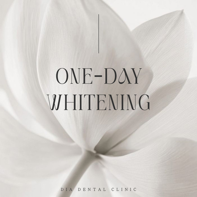 원데이 치아미백 3회 이벤트 썸네일 이미지