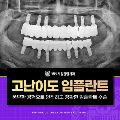 오스템 임플란트 BA 이벤트 썸네일 이미지