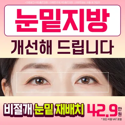 비절개 눈밑지방 재배치 이벤트 썸네일 이미지