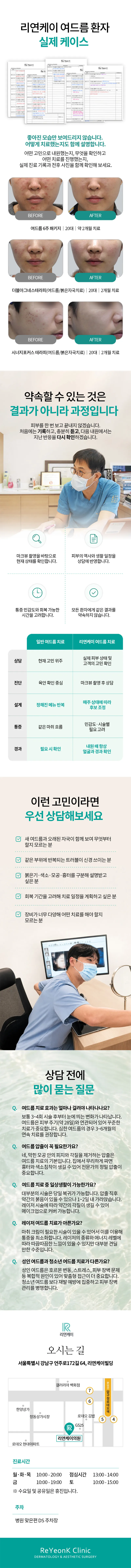  깨끗한 피부의 시작! 여드름 관리