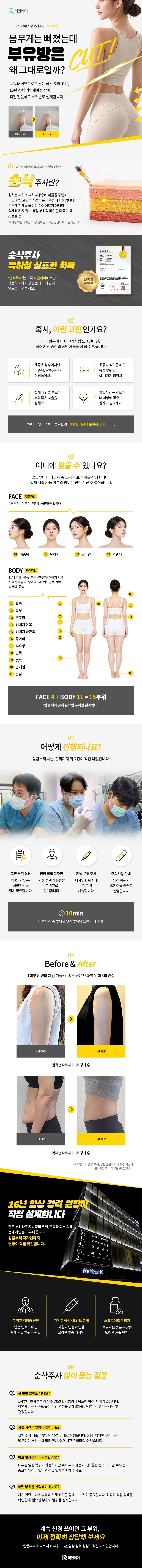 NO스테로이드 지방분해, 부유방 순삭주사