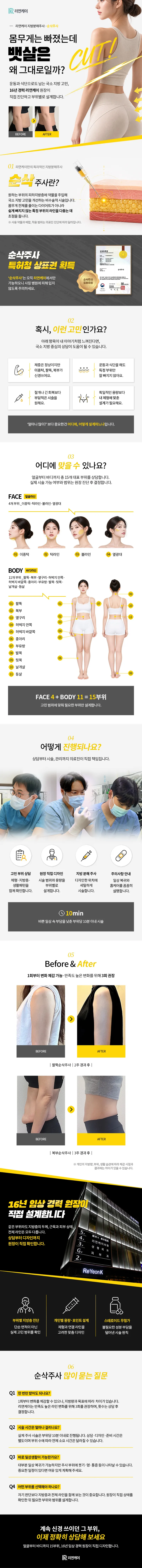 NO스테로이드 지방분해, 복부 순삭주사