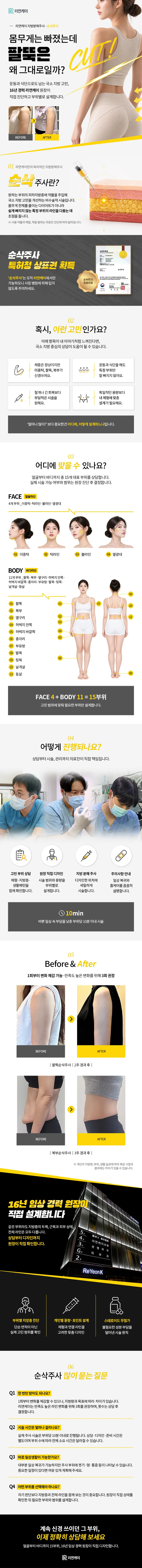 NO스테로이드 지방분해, 팔뚝 순삭주사