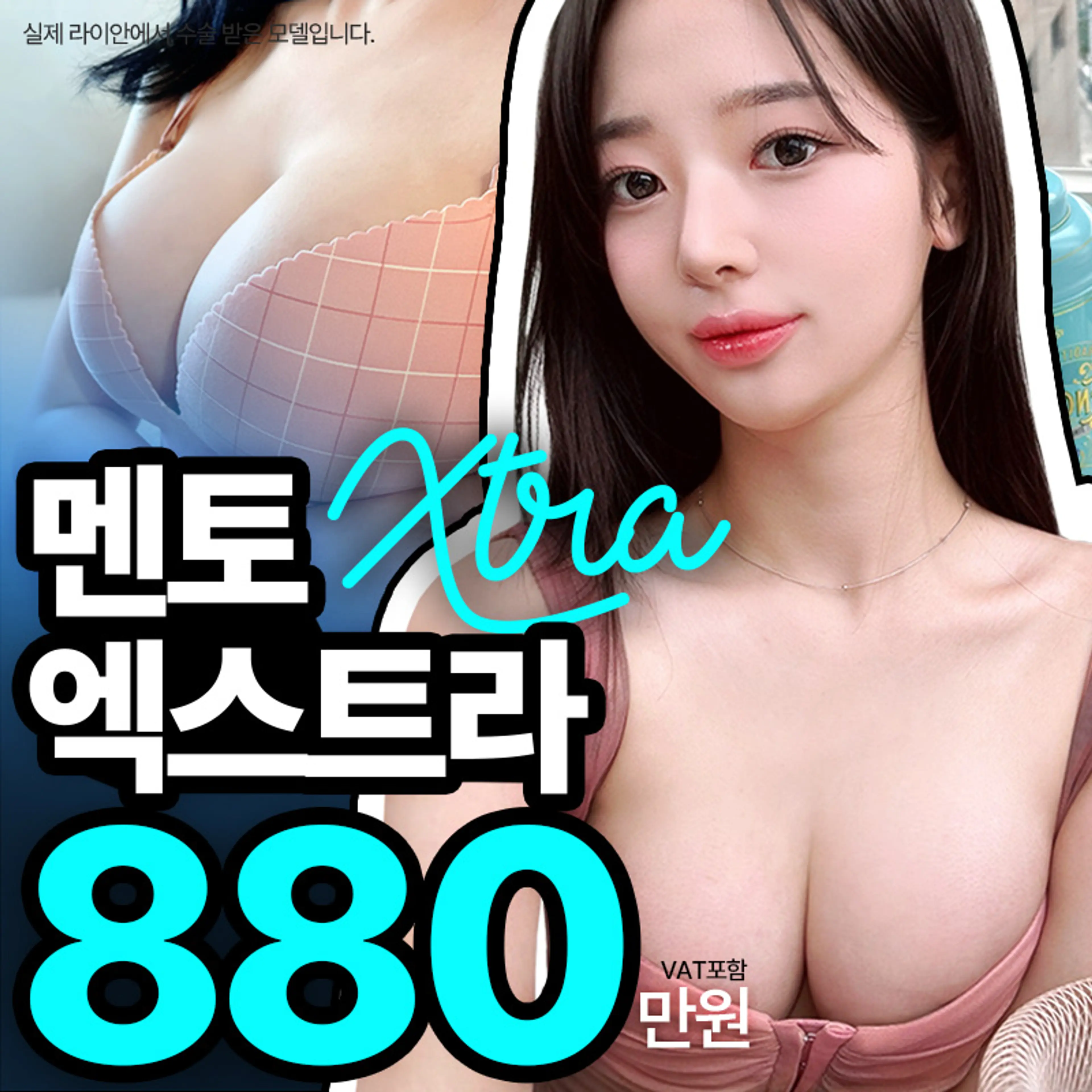 라이안성형외과 멘토 엑스트라 가슴성형