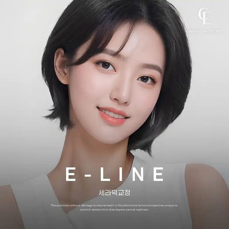 ★퍼스널 치아교정 월 15만원부터~★