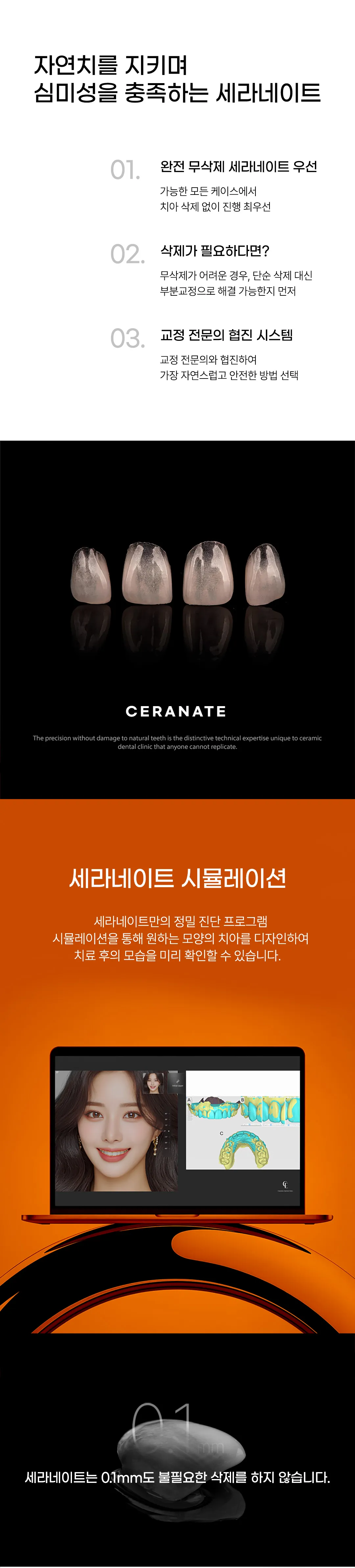 세라믹치과의원 추가비용 없는 무삭제 세라네이트 이벤트, 시술 상세 이미지