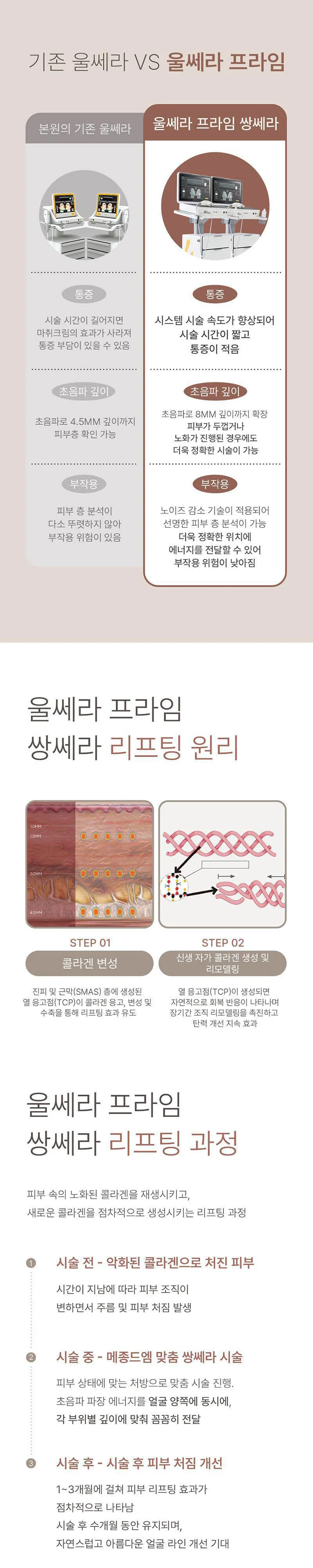 메종드엠의원 울쎄라피 프라임 쌍쎄라 이벤트, 시술 상세 이미지