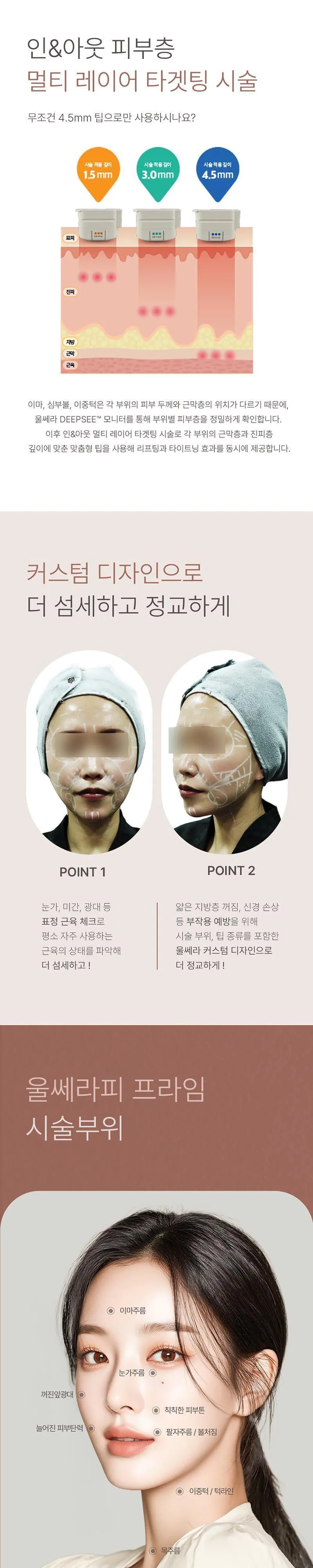 메종드엠의원 울쎄라피 프라임 이벤트, 시술 상세 이미지