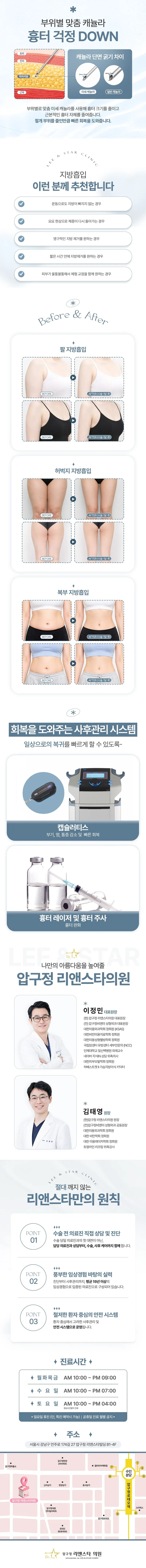지방흡입 - 팔, 팔뚝, 허벅지, 등, 복부, 러브핸들