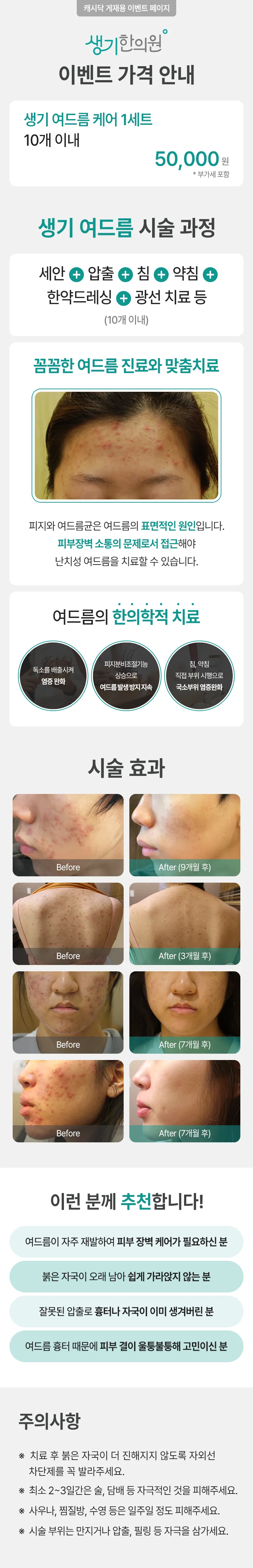 생기한의원-인천점 생기 여드름 케어 1세트 이벤트, 시술 상세 이미지