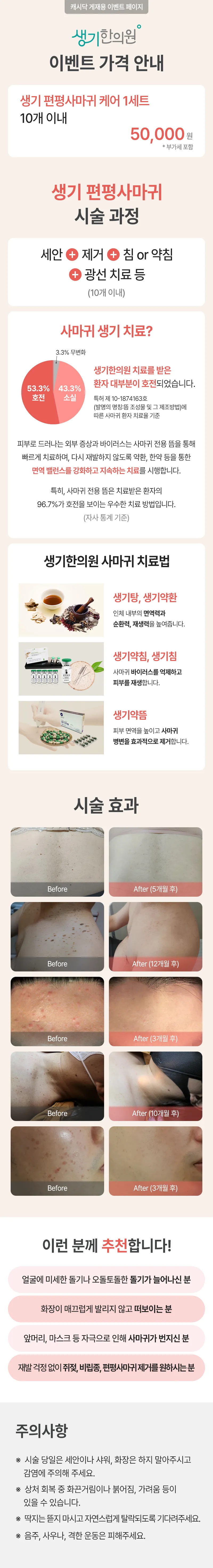 생기한의원-부천점 생기 편평사마귀 케어 1세트 이벤트, 시술 상세 이미지