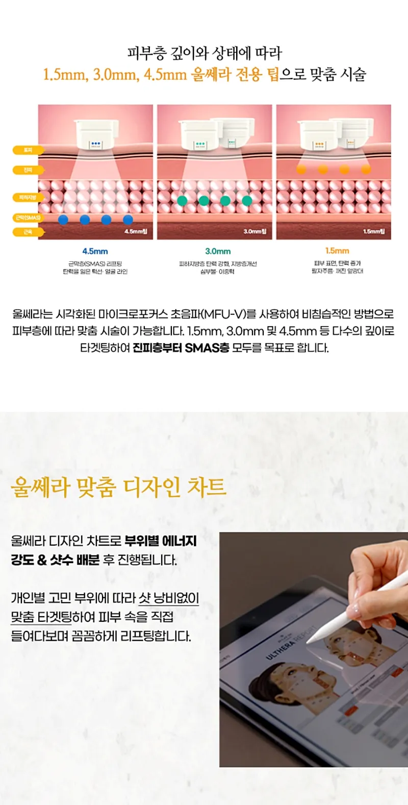 아윤의원 강남 울쎄라피 프라임 100샷 첫방문이벤트 이벤트, 시술 상세 이미지