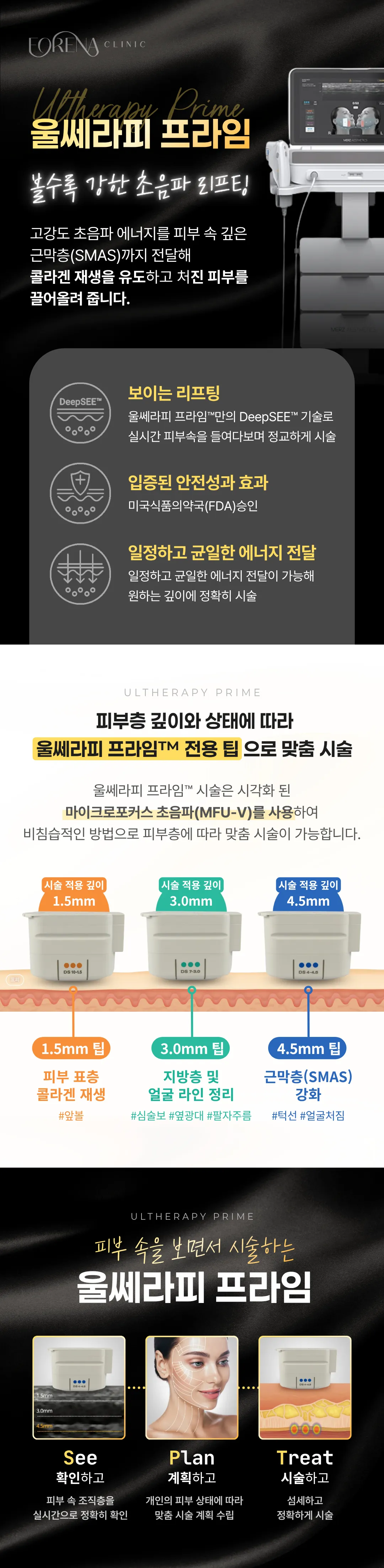 포레나의원 홍대입구역 울쎄라피 프라임 이벤트, 시술 상세 이미지