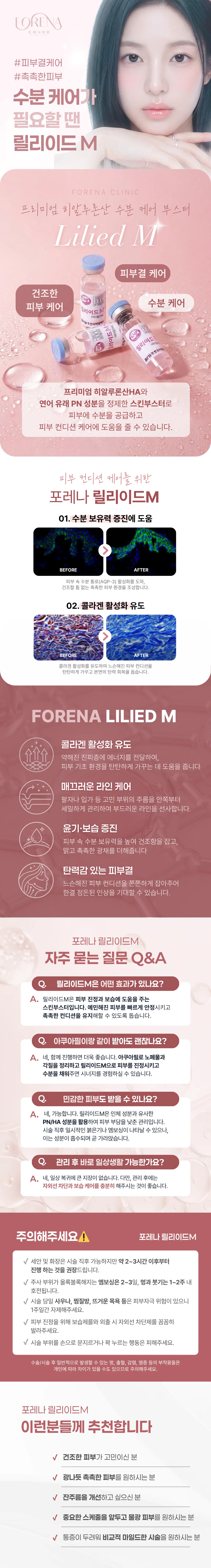 포레나의원 [홍대 포레나의원] 릴리이드M 물광 주사 5cc 이벤트, 시술 상세 이미지