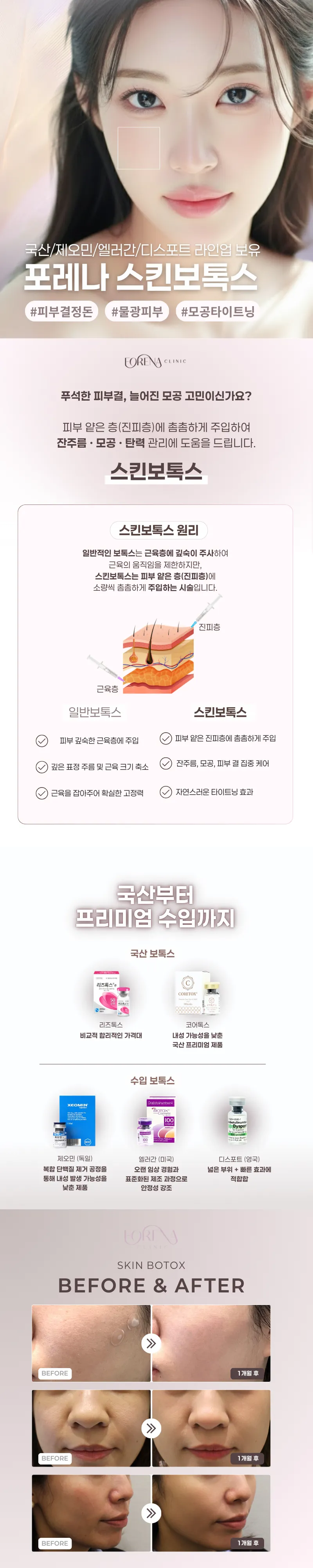포레나의원 스킨보톡스 2cc 이벤트, 시술 상세 이미지