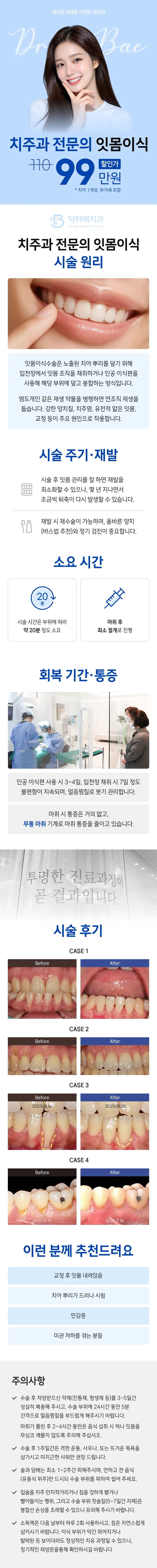 닥터배치과의원 치주과 전문의 잇몸이식 이벤트, 시술 상세 이미지