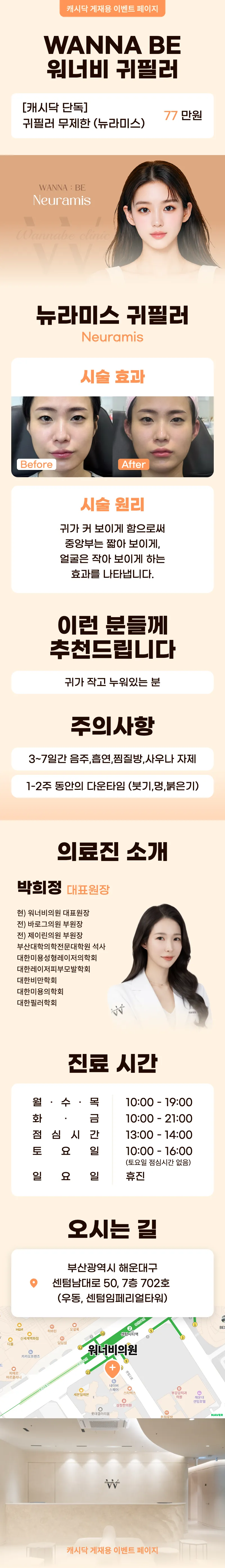 워너비의원 귀필러무제한/뉴라미스 이벤트, 시술 상세 이미지