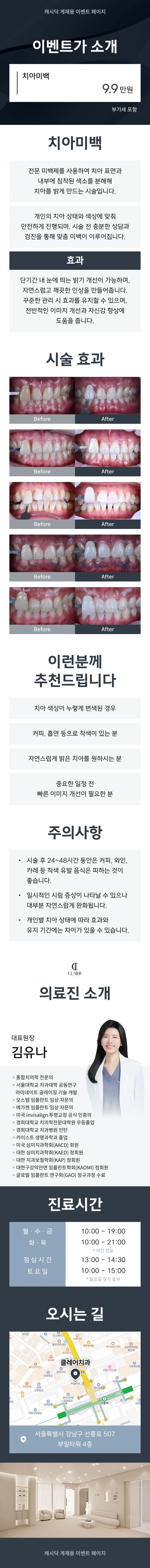 클레어치과 클레어 치아미백 이벤트, 시술 상세 이미지