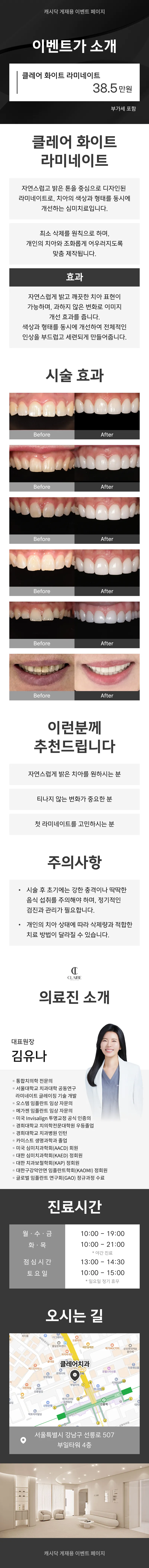 클레어치과 클레어 화이트 라미네이트 이벤트, 시술 상세 이미지
