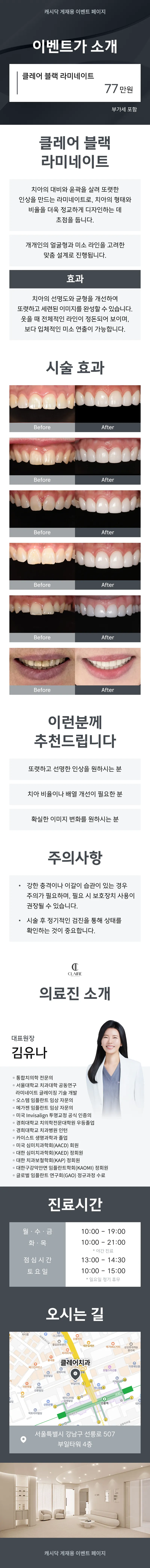 클레어치과 클레어 블랙 라미네이트 이벤트, 시술 상세 이미지