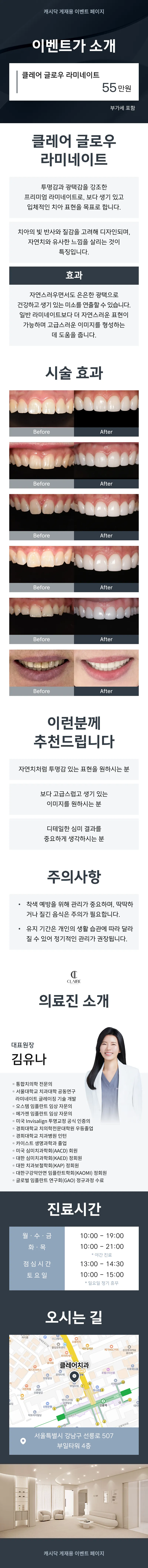 클레어치과 클레어 글로우 라미네이트 이벤트, 시술 상세 이미지