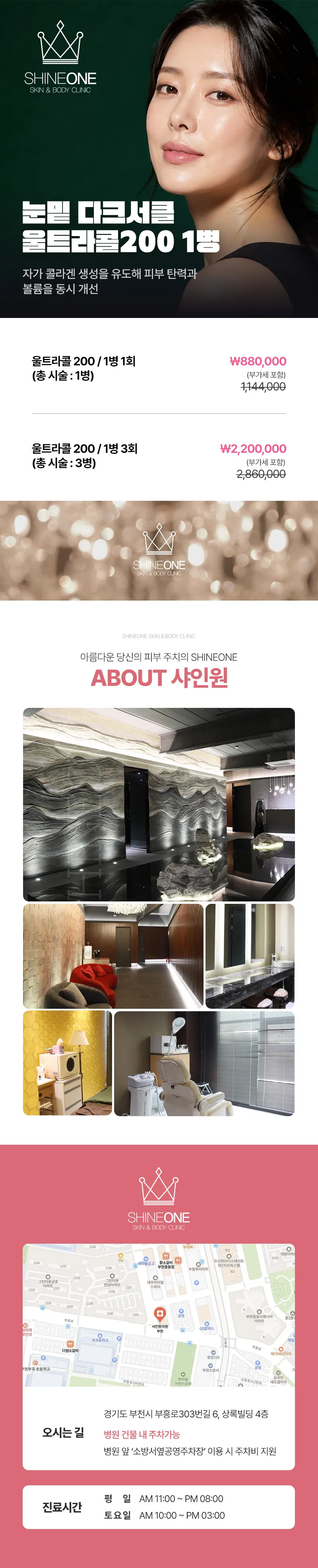 샤인원의원 눈밑 다크서클 울트라콜200 1병 이벤트, 시술 상세 이미지