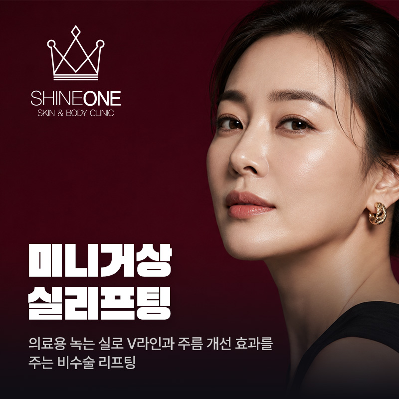 미니거상 실리프팅 이벤트 썸네일 이미지