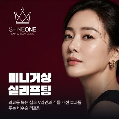 미니거상 실리프팅 이벤트 썸네일 이미지