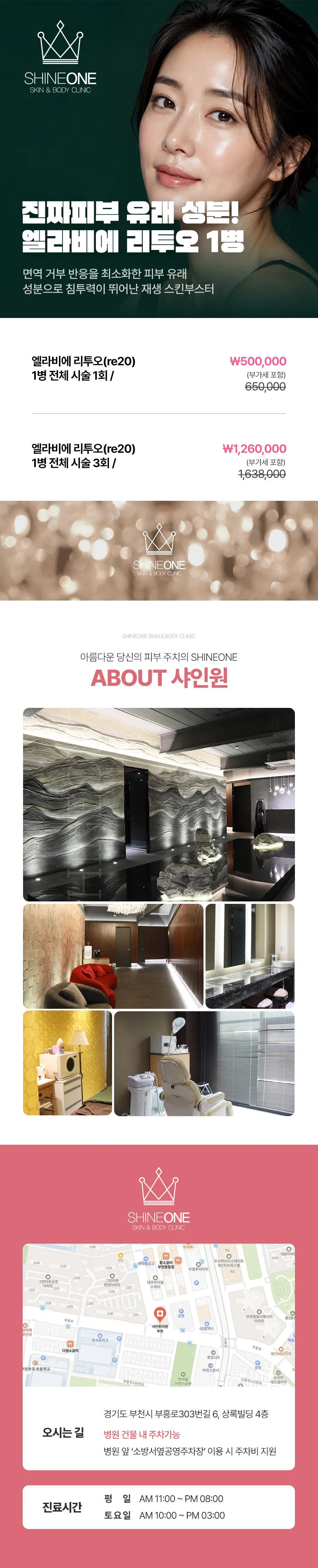 샤인원의원 엘라비에 리투오 1병 (재생) 이벤트, 시술 상세 이미지