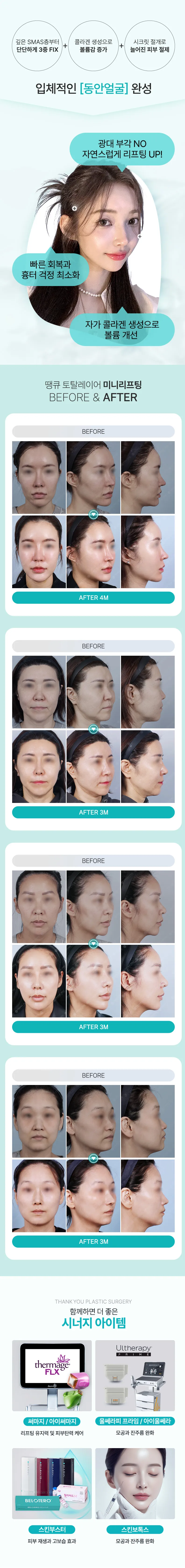 땡큐 토탈레이어 미니리프팅