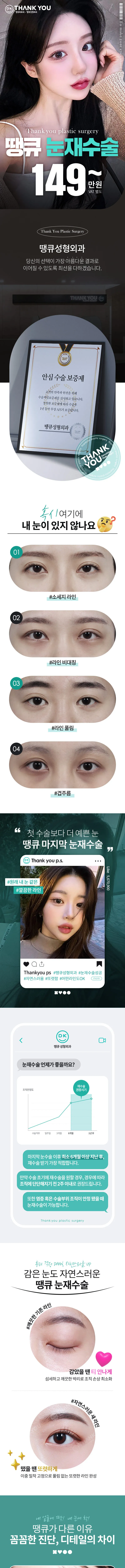땡큐성형외과 땡큐 눈재수술 이벤트, 시술 상세 이미지