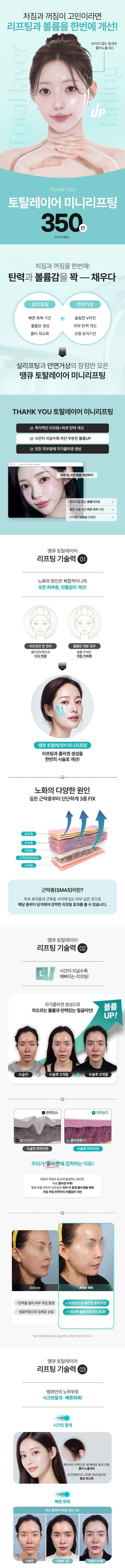 땡큐성형외과 땡큐 토탈레이어 미니리프팅 이벤트, 시술 상세 이미지