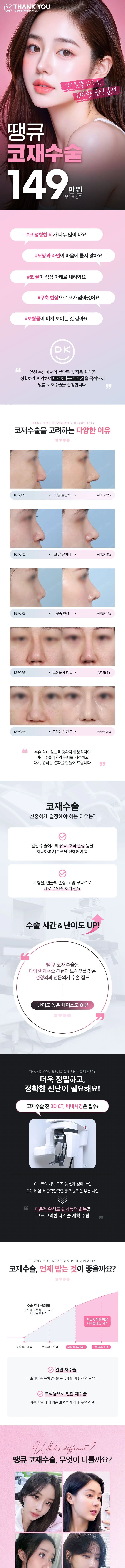 땡큐성형외과 땡큐 코재수술 이벤트, 시술 상세 이미지