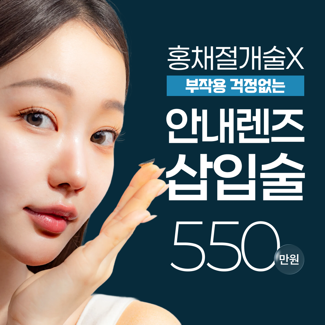 렌즈삽입술 이벤트 썸네일 이미지