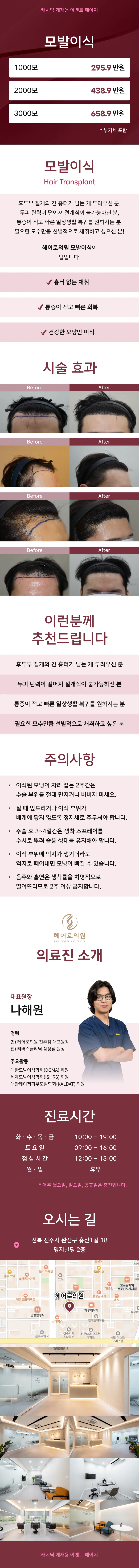 비절개 모발이식