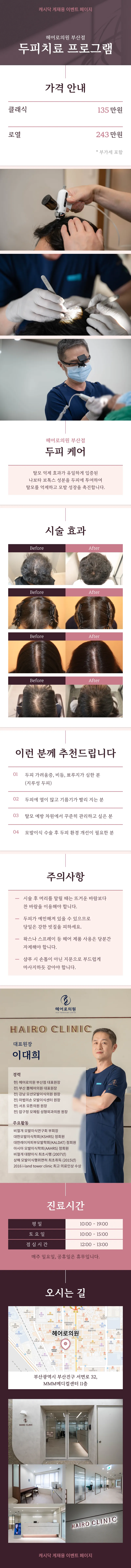 PDLLA頭皮治療プログラム