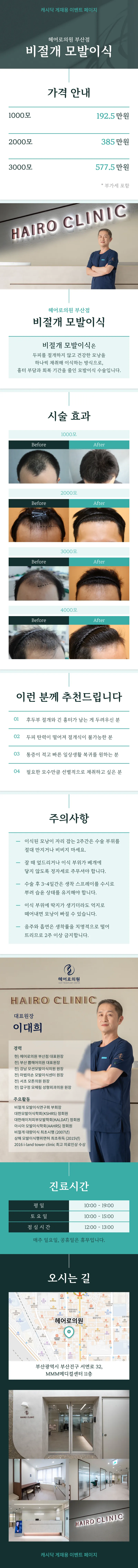 비절개 모발이식