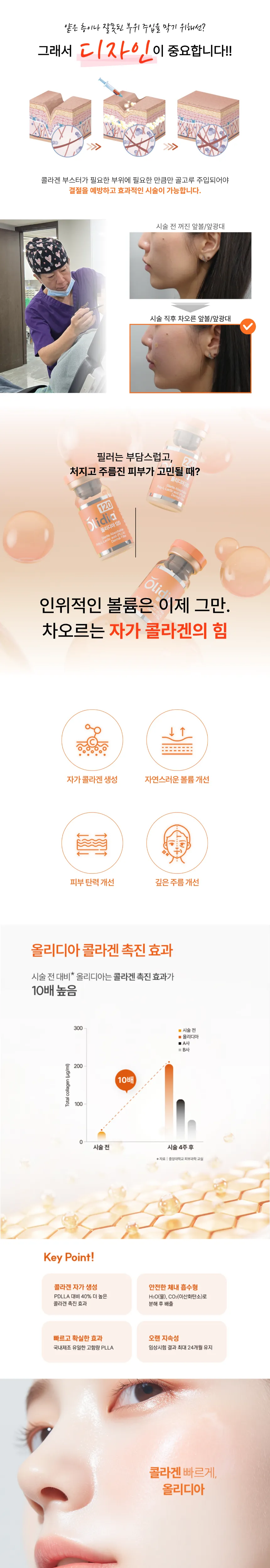 결절이 무서울 땐? 올리디아 콜라겐 부스터