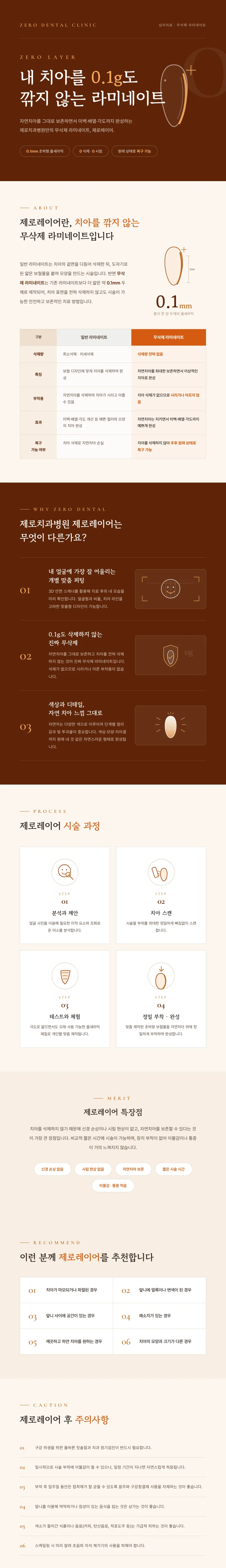 제로치과병원 ☆무삭제 라미네이트, 제로레이어☆ 이벤트, 시술 상세 이미지