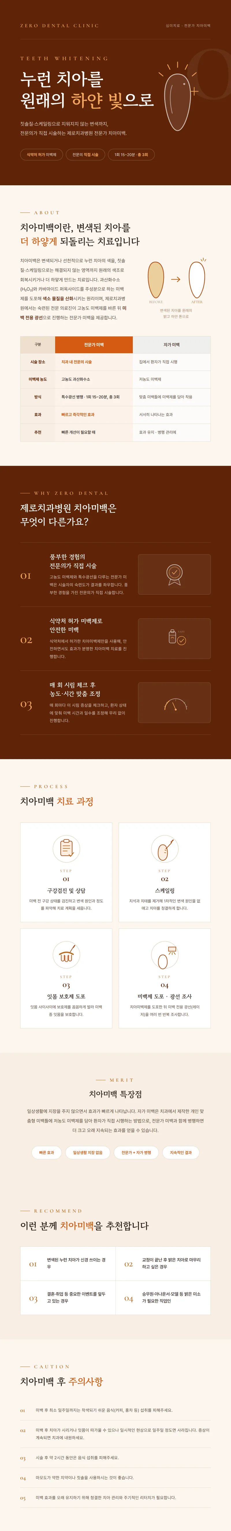 제로치과병원 대구제로치과 전문가 치아미백 이벤트, 시술 상세 이미지