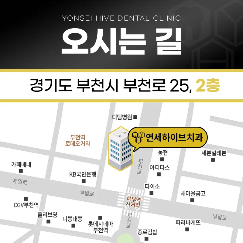 연세하이브치과의원 부천점 부천 임플란트 59만원 → 39만원 이벤트, 시술 상세 이미지