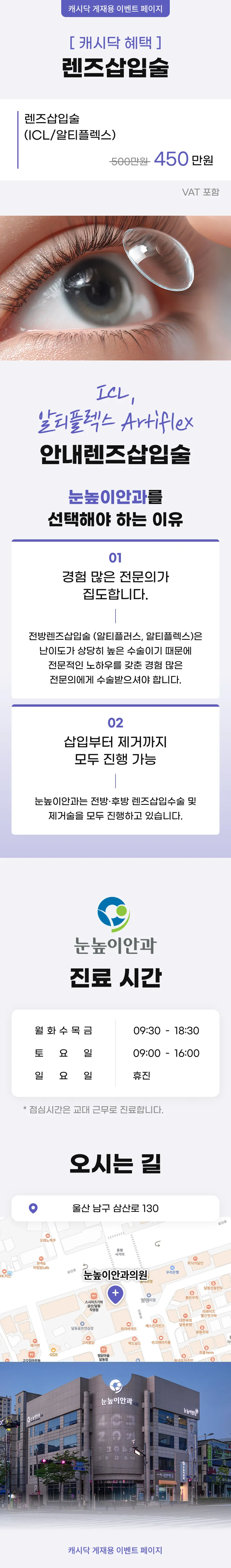 눈높이안과의원 렌즈삽입술 (ICL/알티플렉스) 이벤트, 시술 상세 이미지